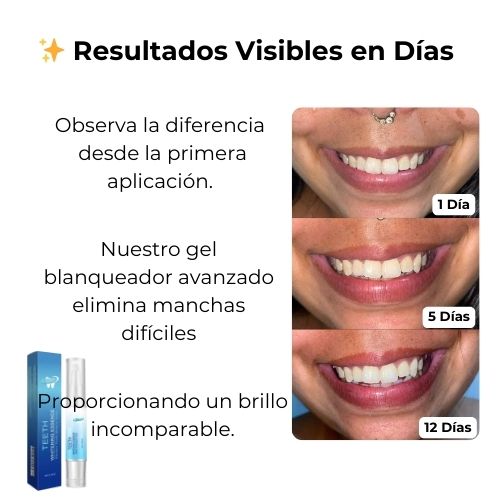 WhitePen Pro