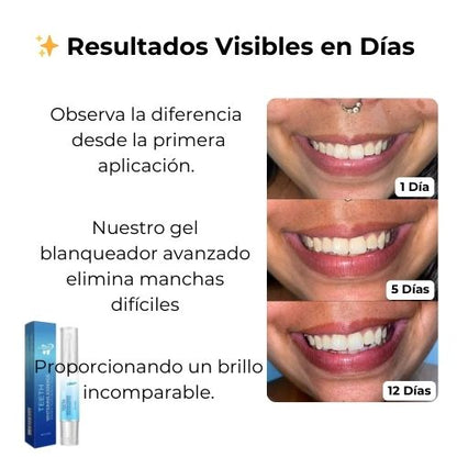 WhitePen Pro